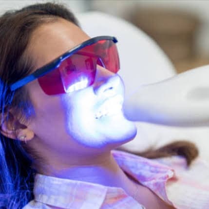 VIP Teeth Whitening Series at EYElashes ETCetera LLC in Ava, MO